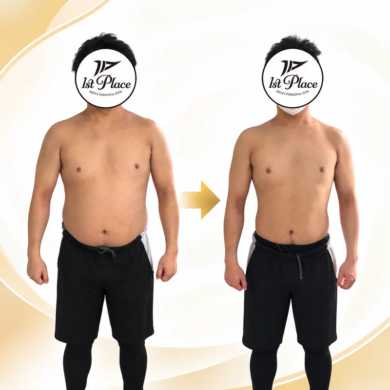 30代・男性のお客様の正面Before After比較。左が開始前、右が終了後