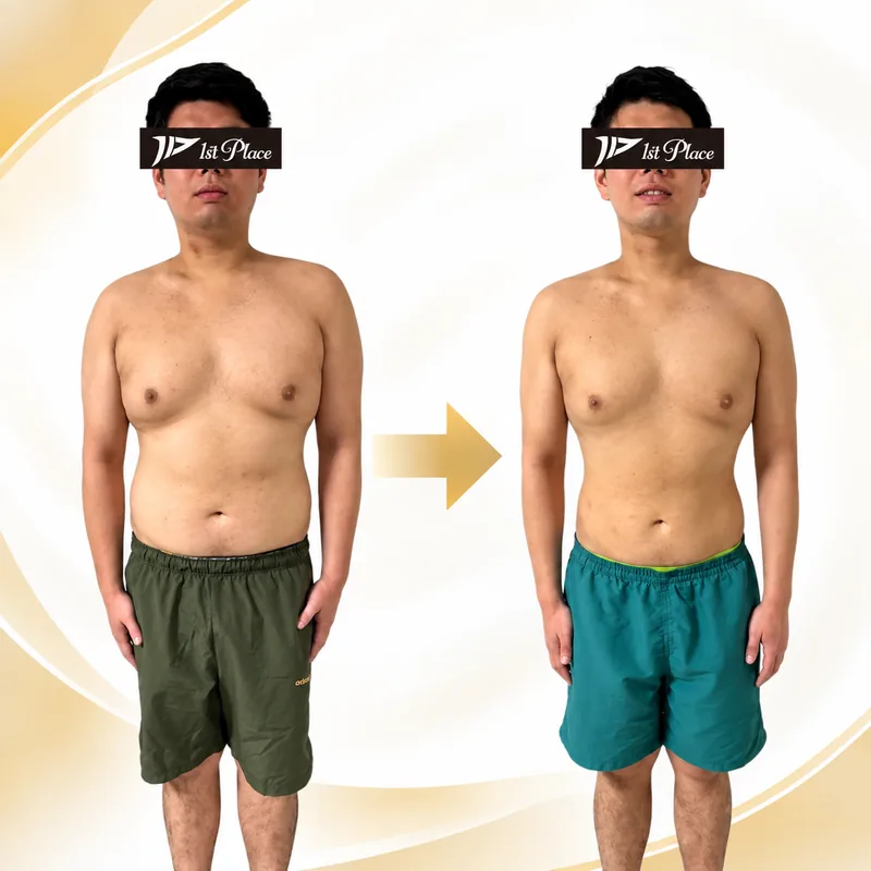 30代／3ヶ月・T様の正面Before After比較。左が開始前、右が終了後